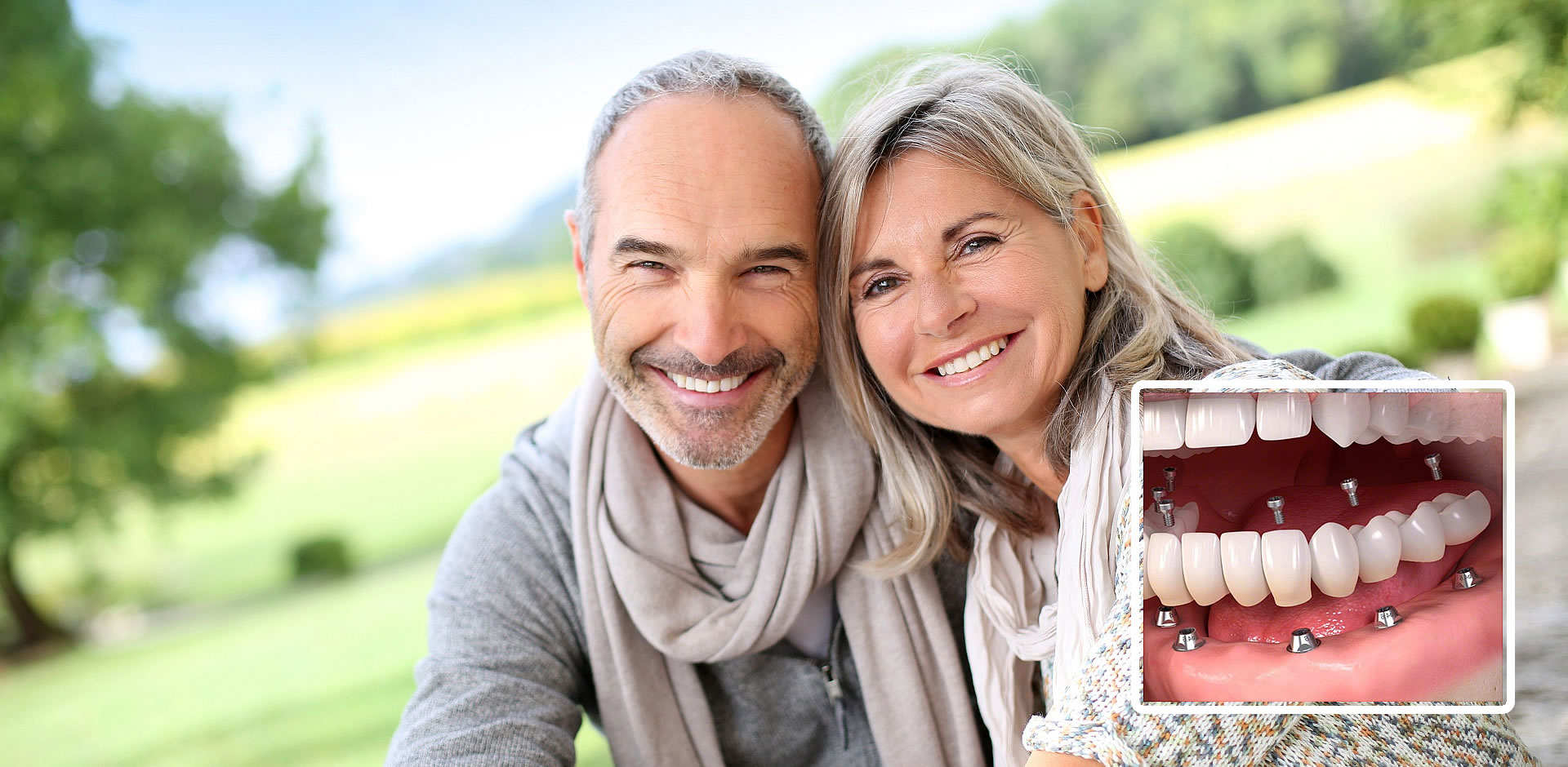 All-on-6     Dental Implants